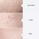 Facial Skincare Face Serum AS1 SA2 AO3 Aqua Peel Solution For Facial Machine Skin Deep Cleaning 400ml Kit of 3 Serums - Image 5